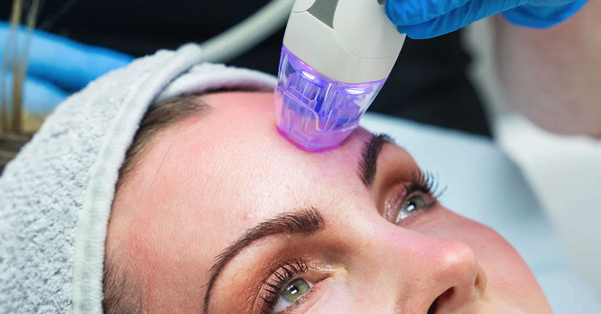 Radio Frequency Microneedling