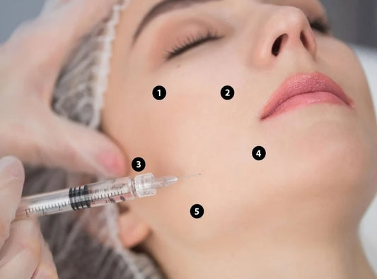 Skin Boosters and Mesotherapy - Exmouth